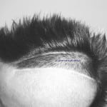 Black and white close-up of a haircut with a shaved design.